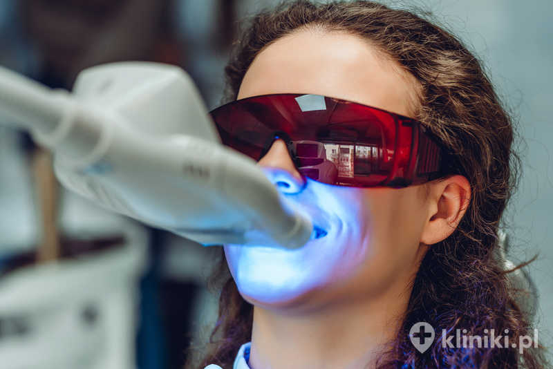 abieg wybielania zębów lampą polega na nałożeniu specjalnego żelu i aktywowaniu go światłem o wysokim natężeniu abieg wybielania zębów lampą polega na nałożeniu specjalnego żelu i aktywowaniu go światłem o wysokim natężeniu
