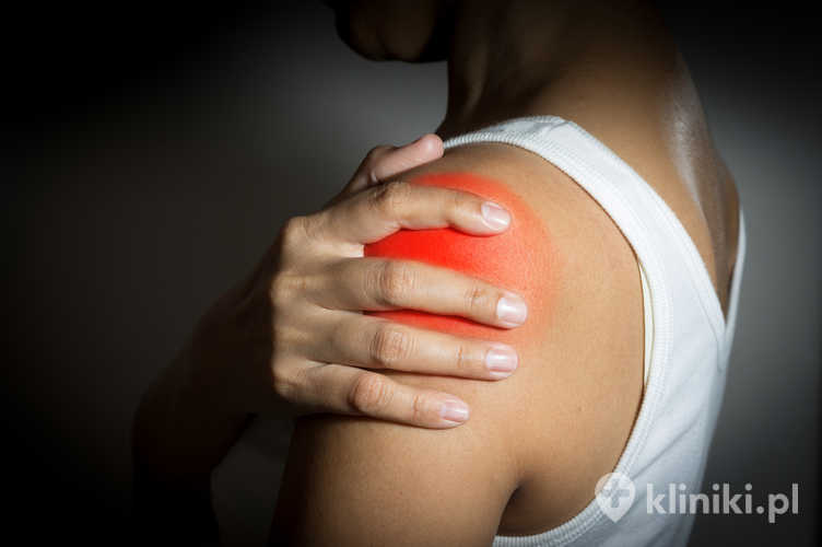 ChatGPT powiedział:

Operacyjne leczenie niestabilności stawu barkowego ma na celu przywrócenie prawidłowej stabilności i funkcji stawu po urazach lub nawracających zwichnięciach