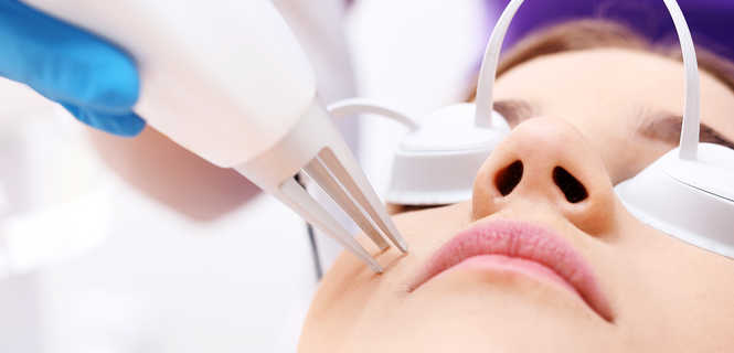 Depilacja laserowa brody