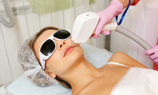 Depilacja laserowa wąsika górna warga