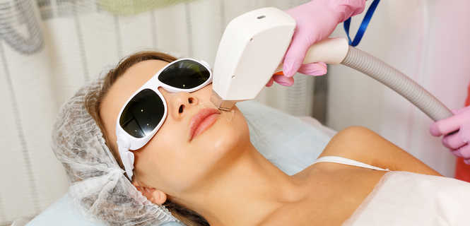 Depilacja laserowa wąsika (górna warga)