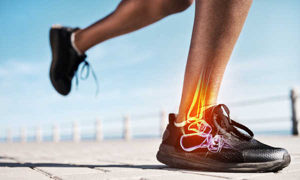 Endoprotezoplastyka stawu skokowego polega na zastąpieniu zniszczonego stawu sztuczną protezą, która odtwarza jego funkcję