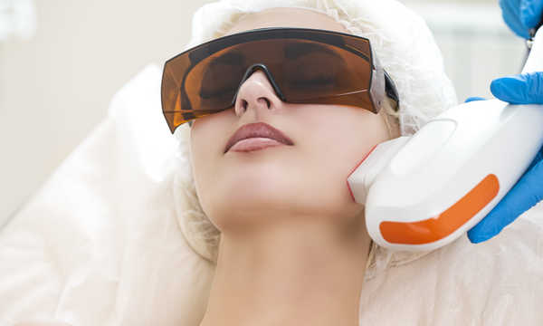 Fotoodmładzanie twarzy, szyi i dekoltu to zabieg wykorzystujący intensywne źródło światła IPL do poprawy kondycji skóry