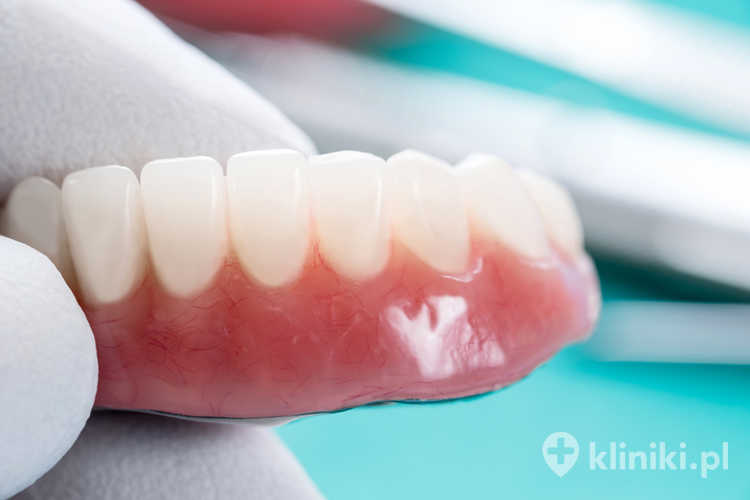 Korona porcelanowa na podbudowie z tlenku cyrkonu łączy wysoką estetykę z wyjątkową trwałością