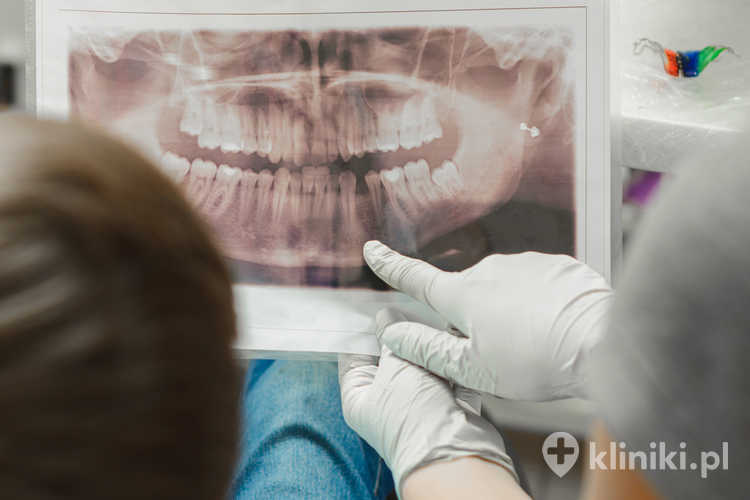 Lekarz ortodonta pokazuje chłopcu prześwietlenie zębów