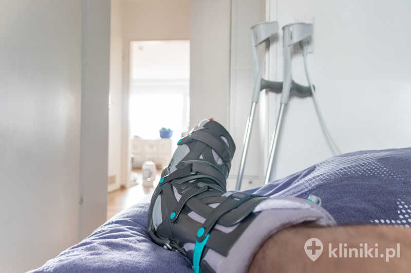 Operacja stopy końsko–szpotawej jest zabiegiem chirurgicznym mającym na celu korekcję nieprawidłowego ustawienia stopy Operacja stopy końsko–szpotawej jest zabiegiem chirurgicznym mającym na celu korekcję nieprawidłowego ustawienia stopy