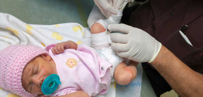 Operacja stopy końsko - szpotawej