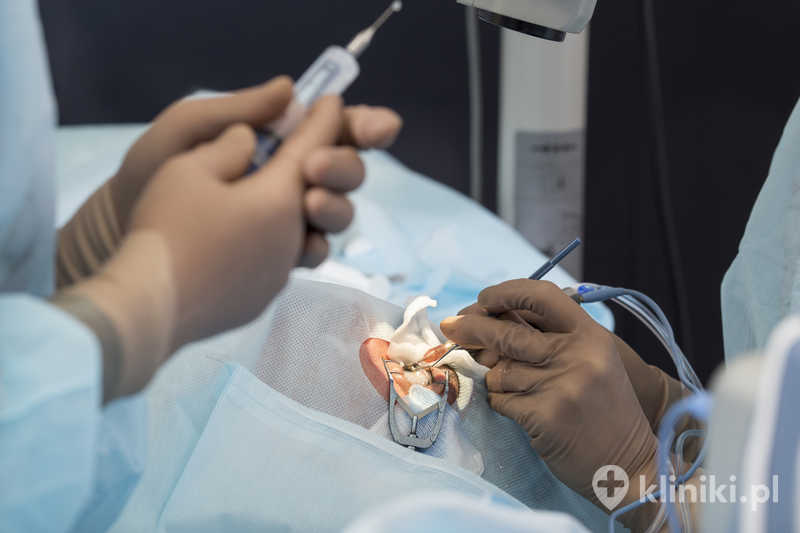 Operacja zaćmy Operacja zaćmy