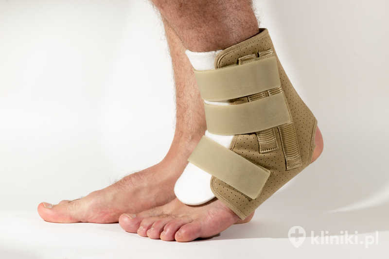 Po endoprotezoplastyce stawu skokowego pacjent wymaga odpowiedniej rehabilitacji w celu przywrócenia sprawności i stabilności chodu Po endoprotezoplastyce stawu skokowego pacjent wymaga odpowiedniej rehabilitacji w celu przywrócenia sprawności i stabilności chodu