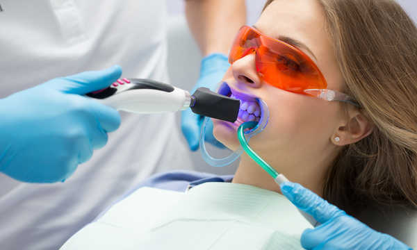 Wybielanie zębów lampą to popularna metoda rozjaśniania szkliwa wykonywana w gabinecie stomatologicznym Wybielanie zębów lampą to popularna metoda rozjaśniania szkliwa wykonywana w gabinecie stomatologicznym