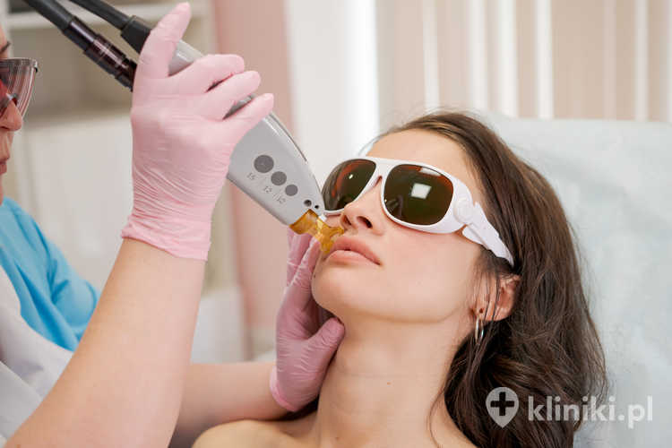 Przebieg zabiegu depilacji laserowej