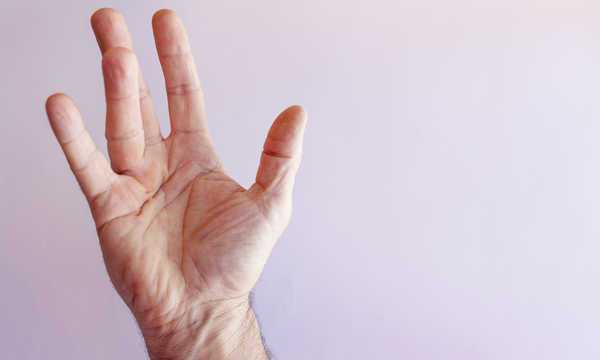 Ręka mężczyzny chorego na przykurcz Dupuytrena