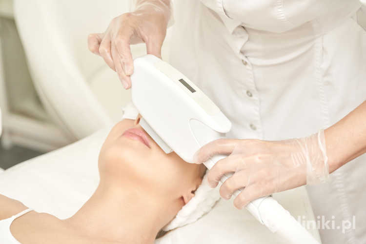 Wskazania do depilacji laserowej wąsika