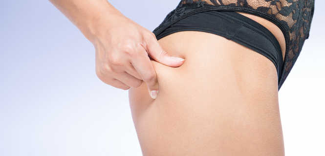 Modelowanie pośladków własnym tłuszczem