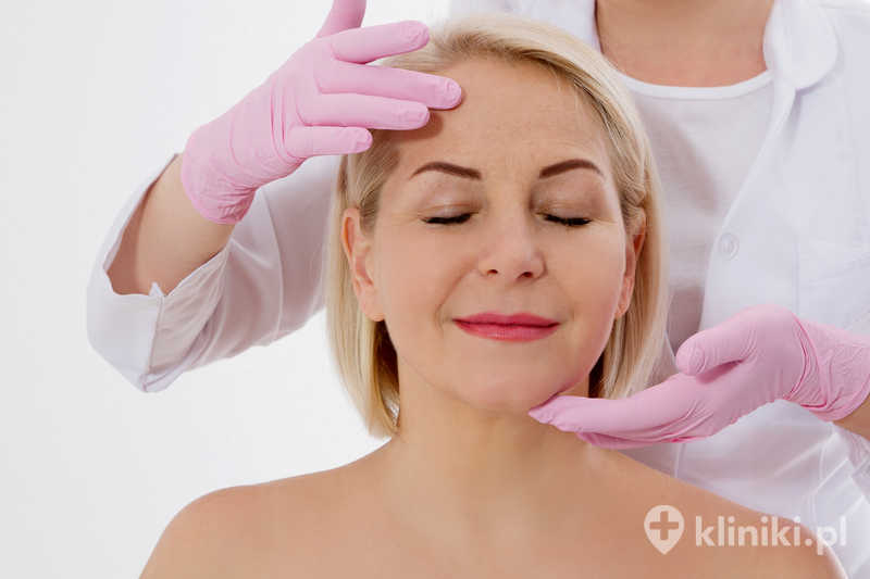 Operacyjne uniesienie czoła i brwi może być wykonywane klasycznie lub techniką endoskopową, która charakteryzuje się mniejszą inwazyjnością i krótszym okresem gojenia Operacyjne uniesienie czoła i brwi może być wykonywane klasycznie lub techniką endoskopową, która charakteryzuje się mniejszą inwazyjnością i krótszym okresem gojenia