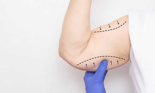 Plastyka ramion to zabieg chirurgiczny mający na celu poprawę kształtu i napięcia skóry w obrębie ramion Plastyka ramion to zabieg chirurgiczny mający na celu poprawę kształtu i napięcia skóry w obrębie ramion