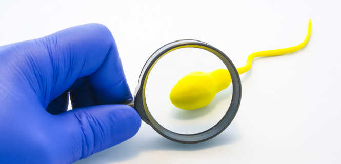 Badanie genetyczne w kierunku niepłodności u mężczyzn