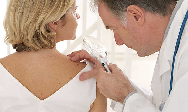 Łagodne i złośliwe zmiany skórne różnią się swoim charakterem, tempem wzrostu oraz potencjałem do naciekania i przerzutów