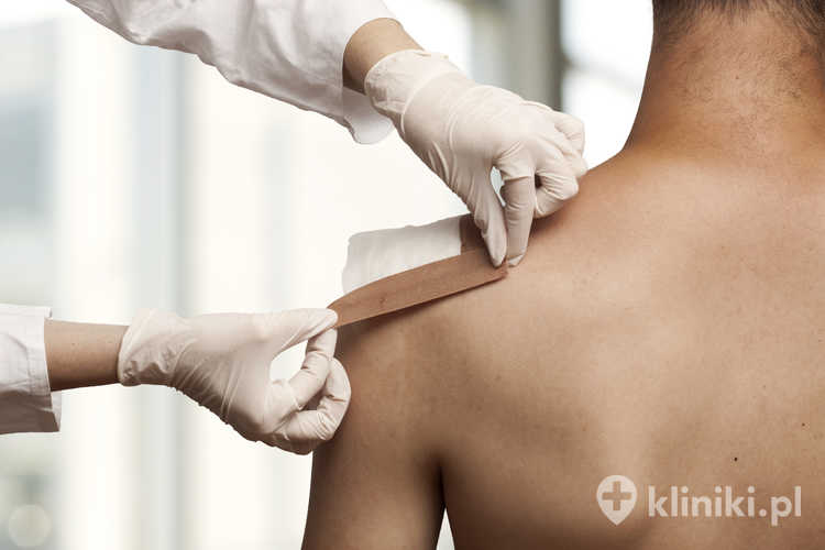 Leczenie przy użyciu larw stosuje się przede wszystkim w trudno gojących się ranach, owrzodzeniach cukrzycowych, odleżynach oraz ranach pooperacyjnych