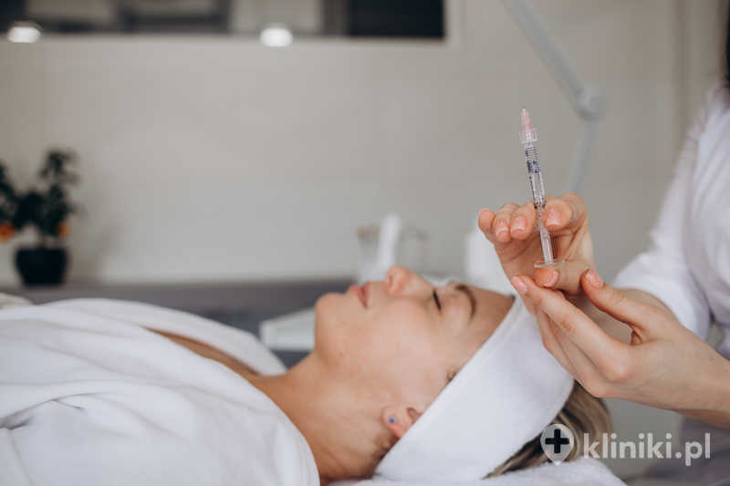 Modelowanie policzków implantami daje trwały efekt, który nie wymaga regularnych powtórzeń jak w przypadku wypełniaczy Modelowanie policzków implantami daje trwały efekt, który nie wymaga regularnych powtórzeń jak w przypadku wypełniaczy