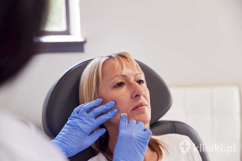 Modelowanie policzków implantami pozwala na uwydatnienie kości policzkowych oraz poprawę proporcji twarzy Modelowanie policzków implantami pozwala na uwydatnienie kości policzkowych oraz poprawę proporcji twarzy