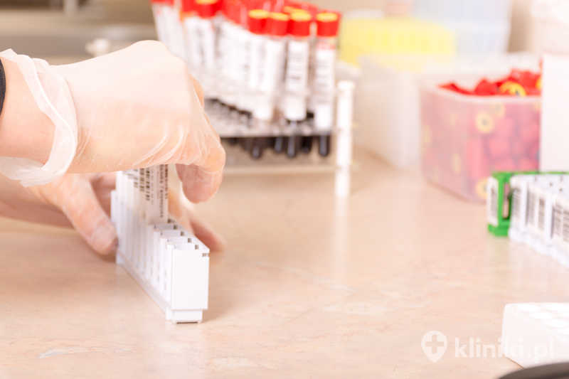 Testy genetyczne na niepłodność u mężczyzn pomagają również wykryć mutacje genu CFTR, związane z wrodzonym brakiem nasieniowodów Testy genetyczne na niepłodność u mężczyzn pomagają również wykryć mutacje genu CFTR, związane z wrodzonym brakiem nasieniowodów