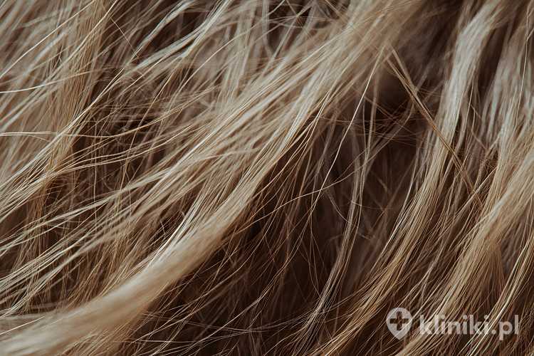 Analiza składu pierwiastkowego włosa bywa wykorzystywana w medycynie funkcjonalnej i dietetyce jako element szerszej oceny stanu zdrowia pacjenta