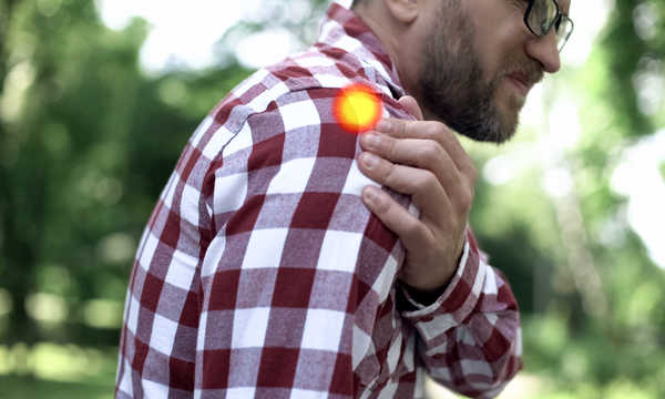 Artroskopowe leczenie zespołu ciasnoty przestrzeni podbarkowej polega na wprowadzeniu kamery i narzędzi chirurgicznych do stawu barkowego przez niewielkie nacięcia skóry Artroskopowe leczenie zespołu ciasnoty przestrzeni podbarkowej polega na wprowadzeniu kamery i narzędzi chirurgicznych do stawu barkowego przez niewielkie nacięcia skóry