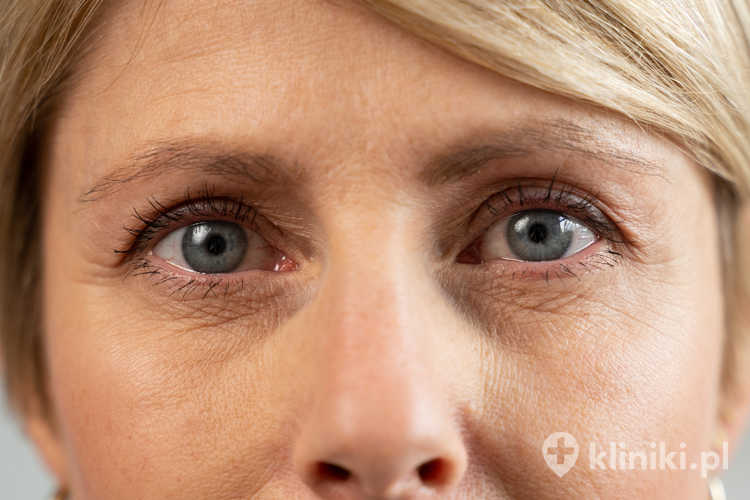 Jednoczesne leczenie zaćmy i prezbiopii polega na wszczepieniu specjalnej soczewki premium, takiej jak multifokalna lub EDOF, która zapewnia dobre widzenie na różne odległości