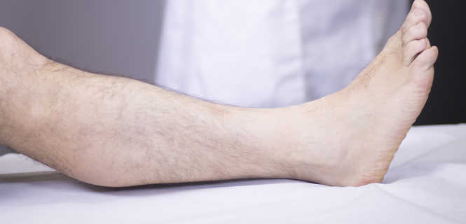 Operacja palca młoteczkowatego stopy