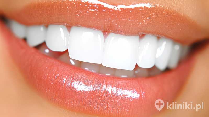 Skuteczność kliniczna Bio-Oss