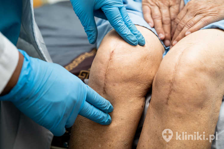 Skuteczność PRP w badaniach