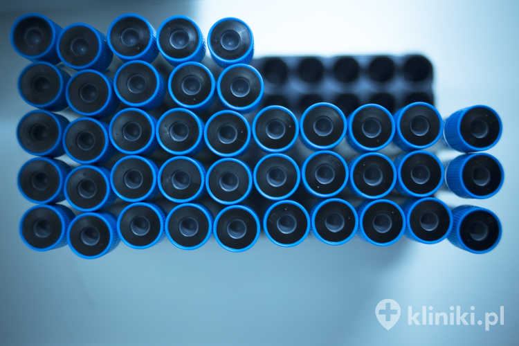 Zastosowania PRP w ortopedii