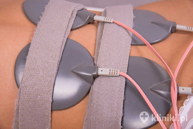 Elektrostymulacja w leczeniu NTM