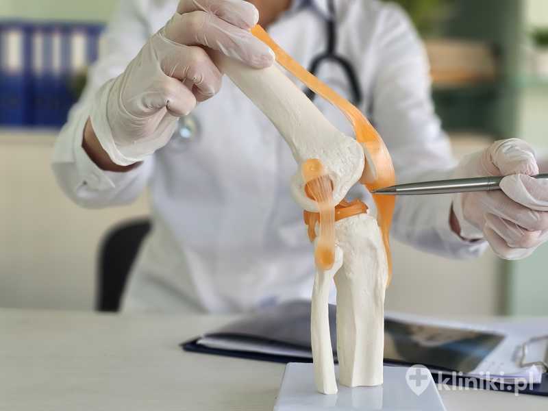 Leczenie chrząstki stawowej metodą wszczepienia membrany kolagenowej stymuluje naturalną regenerację chrząstki Leczenie chrząstki stawowej metodą wszczepienia membrany kolagenowej stymuluje naturalną regenerację chrząstki