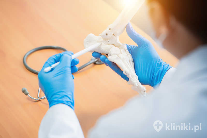 Odtworzenie więzadła strzałkowo-skokowego przedniego polega na wykorzystaniu przeszczepu własnych tkanek pacjenta lub materiału od dawcy Odtworzenie więzadła strzałkowo-skokowego przedniego polega na wykorzystaniu przeszczepu własnych tkanek pacjenta lub materiału od dawcy