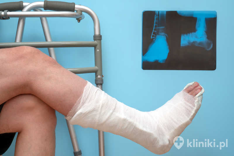 Operacja stawu skokowego często wymaga okresu rehabilitacji, aby odzyskać pełną sprawność Operacja stawu skokowego często wymaga okresu rehabilitacji, aby odzyskać pełną sprawność