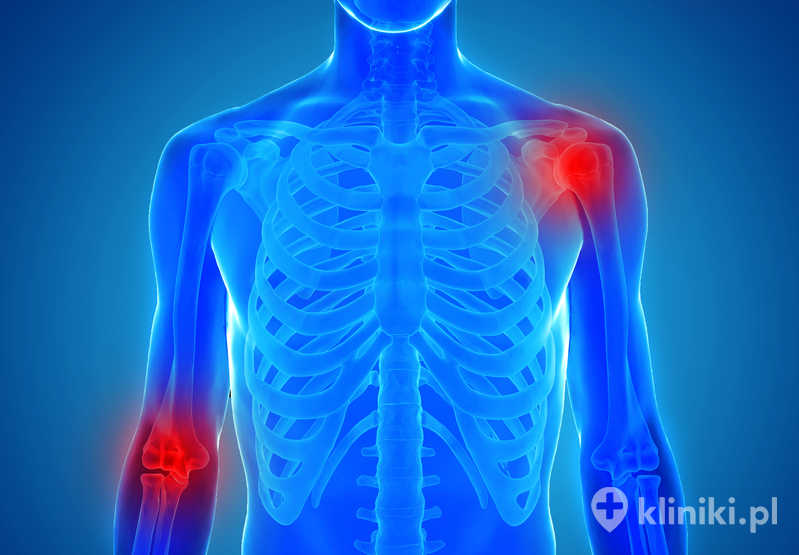 Regeneracja chrząstki stawowej z wykorzystaniem membrany kolagenowej zmniejsza ból i poprawia ruchomość stawu Regeneracja chrząstki stawowej z wykorzystaniem membrany kolagenowej zmniejsza ból i poprawia ruchomość stawu