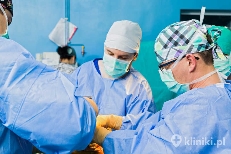 Rekonstrukcja ATFL wykonywana jest najczęściej u pacjentów z przewlekłą niestabilnością kostki i nawracającymi skręceniami Rekonstrukcja ATFL wykonywana jest najczęściej u pacjentów z przewlekłą niestabilnością kostki i nawracającymi skręceniami