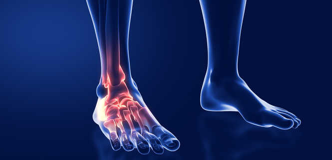 Rekonstrukcja więzadła strzałkowo-skokowego przedniego (ATFL)