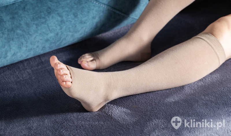 Skleroterapia żylaków pod kontrolą USG umożliwia lekarzowi dokładną ocenę przebiegu żyły, głębokości jej położenia oraz skuteczność wypełnienia jej pianką lub płynem