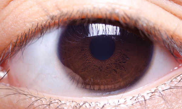 Soczewka sferyczna standardowa w operacjach zaćmy