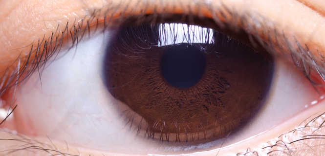 Soczewka sferyczna standardowa w operacjach zaćmy