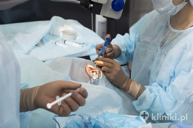 Wymiana soczewki podczas operacji