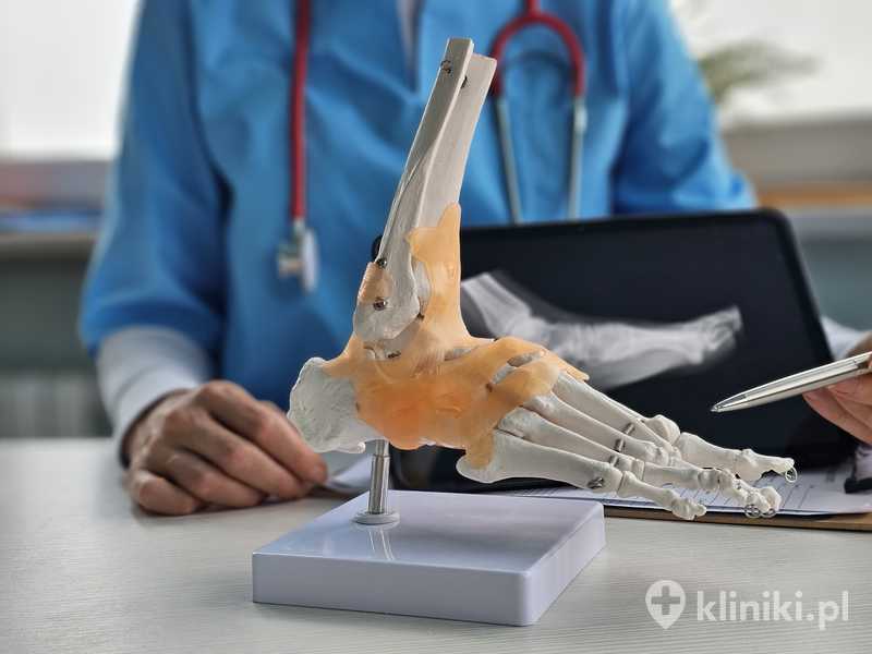 Zabieg stawu skokowego może obejmować artroskopię, rekonstrukcję więzadeł lub wymianę powierzchni stawowych Zabieg stawu skokowego może obejmować artroskopię, rekonstrukcję więzadeł lub wymianę powierzchni stawowych