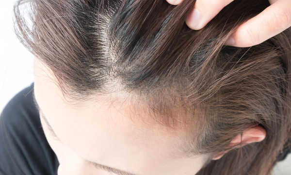 Konsultacja przed transplantacją włosów