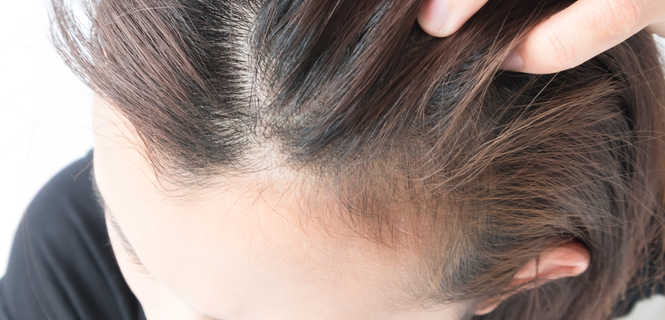 Konsultacja przed transplantacją włosów