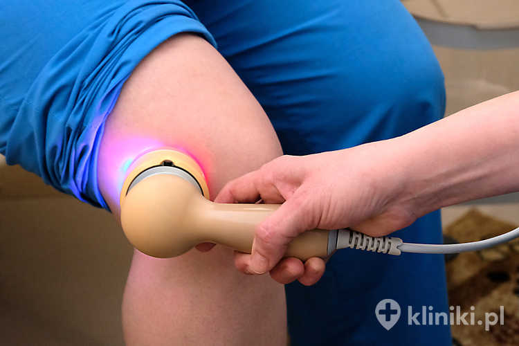 Laser biostymulacyjny wysokoenergetyczny zwiększa mikrokrążenie, co wspiera odżywienie tkanek i przyspieszenie gojenia