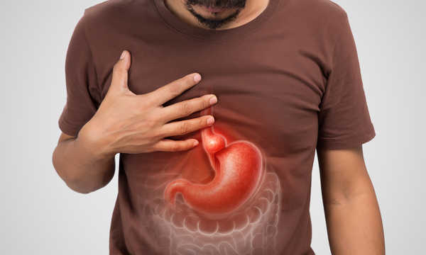 Leczenie choroby refluksowej metodą STRETTA polega na wykorzystaniu energii o częstotliwości radiowej do wzmocnienia dolnego zwieracza przełyku