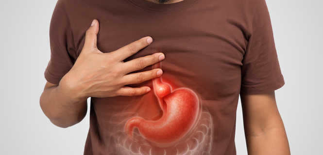 Leczenie choroby refluksowej metodą STRETTA